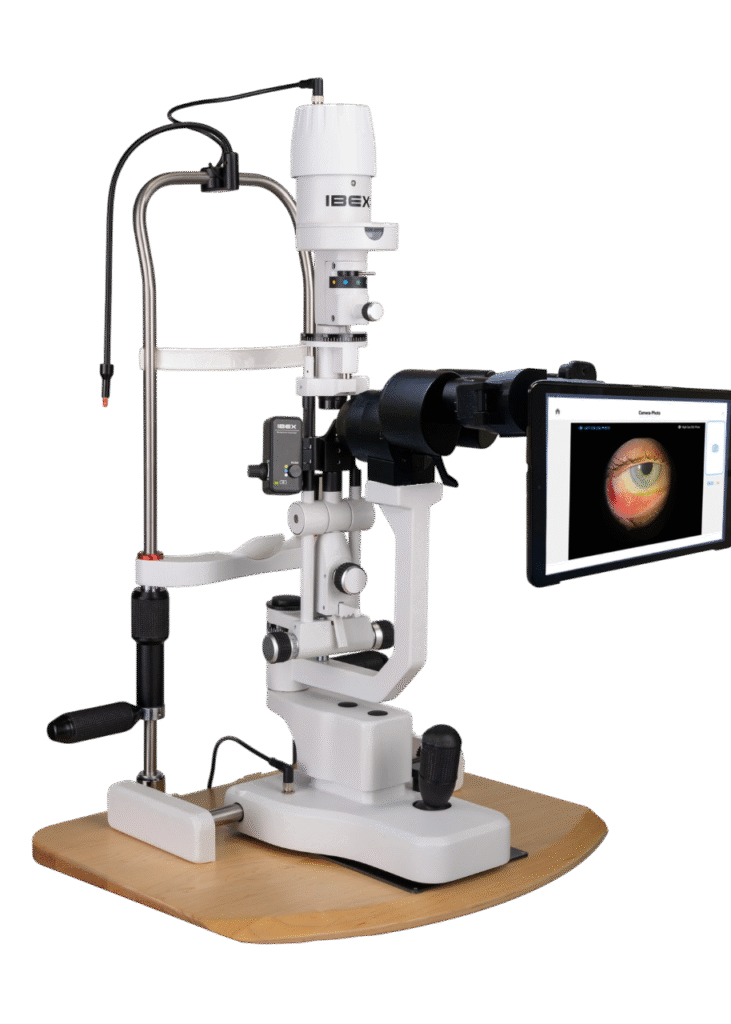 Opteon™ On-Demand Slit Lamp Imaging